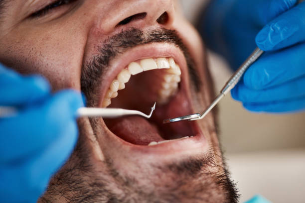 Best Emergency Gum Treatment in Hastings, MI