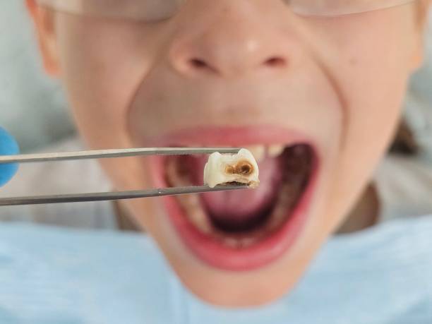 Best Emergency Denture Repair in Hastings, MI